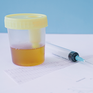 cum să colectezi urina cu prostatita obosit de prostatita cronică