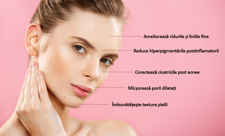 Beneficii microneedling